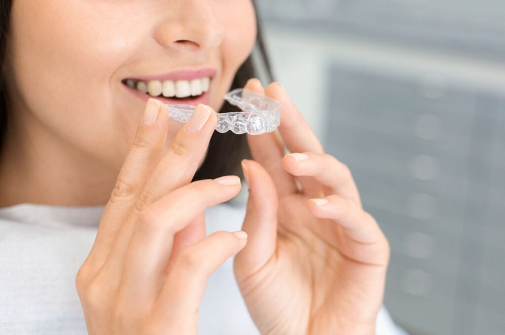 A Complete Guide to Clear Aligners Treatment in Bossier City: What to Expect from Start to Finish